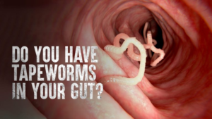 Everything You Need to Know About Tapeworm Infections